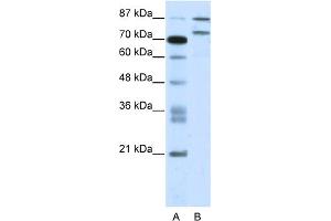 WB Suggested Anti-ZNF709 Antibody Titration:  2. (ZNF709 Antikörper  (N-Term))