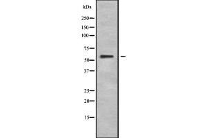 Western blot analysis IL28RA using HeLa whole cell lysates (IL28RA Antikörper  (Internal Region))