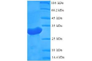 SDS-PAGE (SDS) image for Polymerase (DNA Directed), gamma (POLG) (AA 192-325), (partial) protein (His-SUMO Tag) (ABIN5710716)