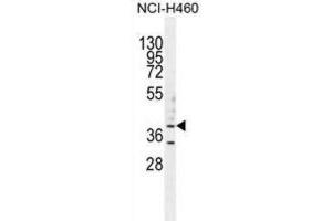 Western Blotting (WB) image for anti-UDP-Gal:betaGlcNAc beta 1,3-Galactosyltransferase, Polypeptide 5 (B3GALT5) antibody (ABIN2996041) (B3GALT5 Antikörper)