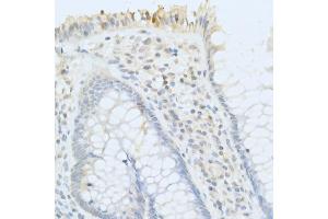 Immunohistochemistry (IHC) image for anti-Acid Phosphatase, Prostate (ACPP) (AA 40-300) antibody (ABIN3022672)