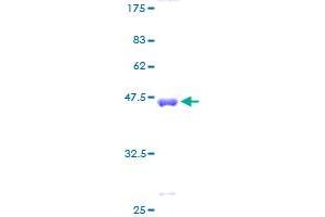 CSRP3 Protein (AA 1-194) (GST tag)