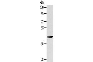 Western Blotting (WB) image for anti-TNFAIP3 Interacting Protein 2 (TNIP2) antibody (ABIN2427435)