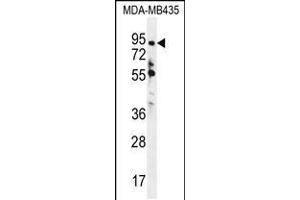 Western blot analysis in MDA-MB435 cell line lysates (35ug/lane). (ZNF605 Antikörper  (N-Term))