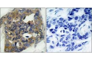 Image no. 1 for anti-Mitogen-Activated Protein Kinase Kinase Kinase 5 (MAP3K5) (pSer966) antibody (ABIN196915) (ASK1 Antikörper  (pSer966))