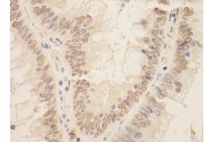 Immunohistochemistry (IHC) image for anti-Zinc Finger E-Box Binding Homeobox 2 (ZEB2) (AA 1164-1214) antibody (ABIN7453813)