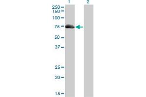 Western Blotting (WB) image for anti-A Kinase (PRKA) Anchor Protein 10 (AKAP10) (AA 1-101) antibody (ABIN599175) (AKAP10 Antikörper  (AA 1-101))