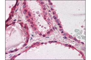 Human Thyroid (formalin-fixed, paraffin-embedded) stained with PAFAH1B1at 3. (PAFAH1B1 Antikörper  (C-Term))