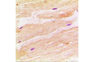 Immunohistochemical analysis of RRAD staining in human muscle formalin fixed paraffin embedded tissue section. (RRAD Antikörper  (Center))