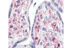 IHC analysis of FFPE human placenta tissue stained with IRAK antibody (IRAK1 Antikörper  (AA 683-712))