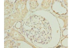 Immunohistochemistry of paraffin-embedded human kidney tissue using ABIN7170672 at dilution of 1:100 (SLA Antikörper  (AA 2-276))