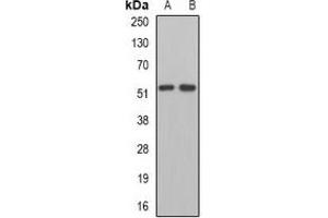 Western blot analysis of MPP1 expression in Jurkat (A), mouse kidney (B) whole cell lysates.