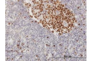 Immunostaining (ISt) image for anti-Chromatin Assembly Factor 1, Subunit B (p60) (CHAF1B) (AA 1-559) antibody (ABIN950155)