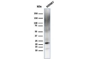 Western Blot Analysis of human kidney cell lysate using Ferritin, Light Chain Mouse Monoclonal Antibody (FTL/1387). (FTL Antikörper  (AA 38-165))