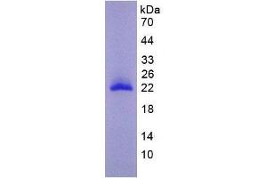 Image no. 2 for Matrix Metallopeptidase 9 (Gelatinase B, 92kDa Gelatinase, 92kDa Type IV Collagenase) (MMP9) (AA 225-413) protein (His tag) (ABIN1980762)