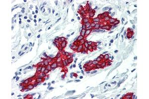 Anti-Cytokeratin 19 antibody IHC of human breast. (Cytokeratin 19 Antikörper)