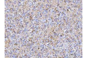 IHC analysis of PTN using anti-PTN antibody (ABIN7602164).