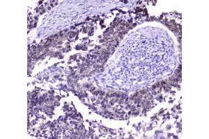 anti-HSP70 1A/ 1B antibody