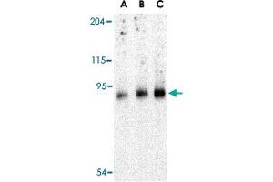 Western blot analysis of TRPC6 in mouse lung tissue lysate with TRPC6 polyclonal antibody  at (A) 0. (TRPC6 Antikörper  (C-Term))