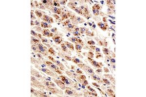 Immunohistochemical analysis of paraffin-embedded H. (Dihydrofolate Reductase Antikörper  (N-Term))