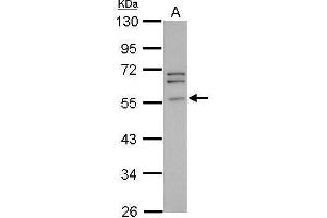 WB Image Sample (30 ug of whole cell lysate) A: PC-3 10% SDS PAGE antibody diluted at 1:1000 (Peripherin Antikörper)