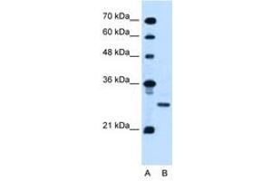 Image no. 1 for anti-Podoplanin (PDPN) (AA 97-146) antibody (ABIN6736674)