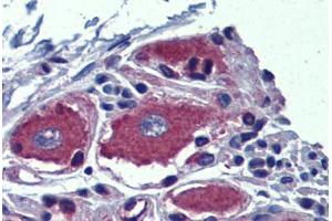 Ganglion cells: Formalin-Fixed, Paraffin-Embedded (FFPE) (AIPL1 Antikörper  (Internal Region))