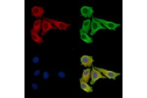 ABIN7097105 and ABIN7101172 staining Hela cells by IF/ICC. (Chromosome 7 Open Reading Frame 20 (C7orf20) Antikörper)