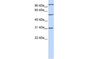 WB Suggested Anti-RAI14 Antibody Titration: 0.
