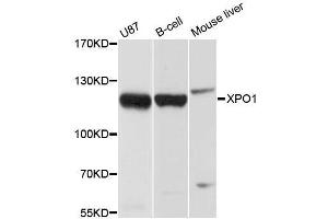 Western blot analysis of extracts of various cell lines, using XPO1 antibody. (XPO1 Antikörper  (C-Term))