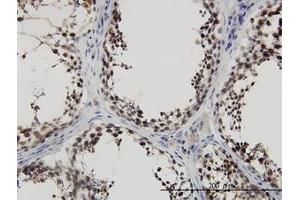 Image no. 3 for anti-PDZ Binding Kinase (PBK) (AA 1-110) antibody (ABIN599275) (PBK Antikörper  (AA 1-110))