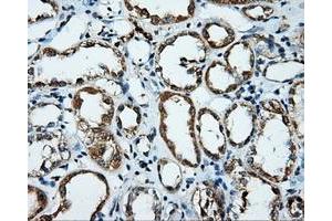 Immunohistochemical staining of paraffin-embedded Kidney tissue using anti-PLEK mouse monoclonal antibody. (Pleckstrin Antikörper)
