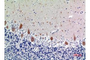 Immunohistochemistry (IHC) analysis of paraffin-embedded Human Brain, antibody was diluted at 1:100. (KIR3DL1 Antikörper)
