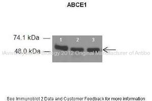 Researcher: Dr. (ABCE1 Antikörper  (C-Term))