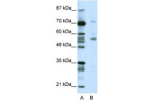 WB Suggested Anti-CORO1A  Antibody Titration: 2. (Coronin 1a Antikörper  (N-Term))