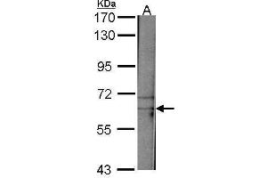 Western Blotting (WB) image for anti-TAF15 RNA Polymerase II, TATA Box Binding Protein (TBP)-Associated Factor, 68kDa (TAF15) (Center) antibody (ABIN2855557)