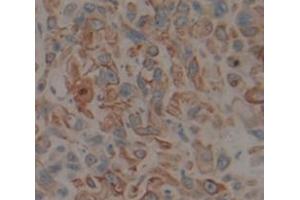 IHC-P analysis of Human Tissue, with DAB staining. (CYP1A1 Antikörper  (AA 1-250))
