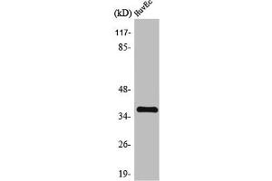 Western Blot analysis of MCF7 cells using TIS11B Polyclonal Antibody (ZFP36L1 Antikörper)
