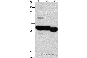 Western blot analysis of Mouse liver and kidney tissue, human fetal liver tissue, using KHK Polyclonal Antibody at dilution of 1:1250 (Ketohexokinase Antikörper)