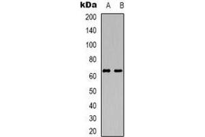 Western blot analysis of DCP1A expression in HuvEc (A), Jurkat (B) whole cell lysates. (DCP1A Antikörper)