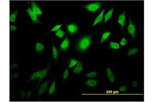 Immunofluorescence of monoclonal antibody to TESK2 on HeLa cell. (TESK2 Antikörper  (AA 405-542))