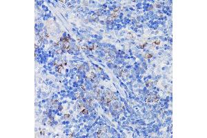 Immunohistochemistry of paraffin-embedded rat spleen using Clusterin alpha chain Rabbit pAb (ABIN6133477, ABIN6138756, ABIN6138758 and ABIN6216721) at dilution of 1:100 (40x lens). (Clusterin Antikörper  (AA 23-120))