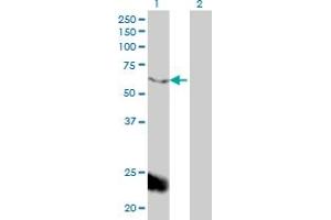Western Blot analysis of PPARBP expression in transfected 293T cell line by PPARBP monoclonal antibody (M01), clone 2A2. (MED1 Antikörper  (AA 1391-1490))