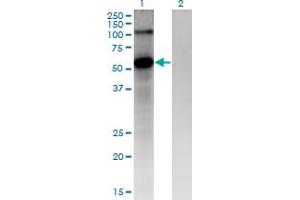 Western Blot analysis of FZD4 expression in transfected 293T cell line by FZD4 monoclonal antibody (M02), clone 3G7.