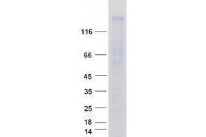 Validation with Western Blot (WWC1 Protein (Myc-DYKDDDDK Tag))