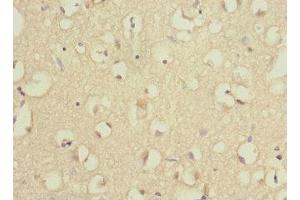 Immunohistochemistry of paraffin-embedded human brain tissue using ABIN7142540 at dilution of 1:100 (RPS27 Antikörper  (AA 1-84))