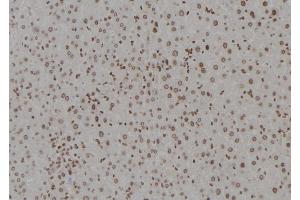 ABIN6277358 at 1/100 staining Mouse liver tissue by IHC-P. (DDB1 Antikörper  (C-Term))