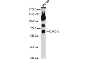 Western blot analysis of extracts of SW480 cells, using CORO1C antibody (ABIN1679327, ABIN3019058, ABIN3019059 and ABIN6220690) at 1:1000 dilution. (CORO1C Antikörper  (AA 375-474))