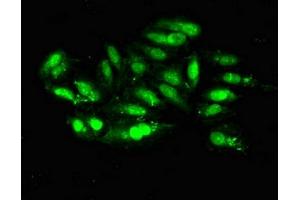 Immunofluorescent analysis of Hela cells using ABIN7150624 at dilution of 1:100 and Alexa Fluor 488-congugated AffiniPure Goat Anti-Rabbit IgG(H+L) (Mre11 Antikörper  (AA 1-205))