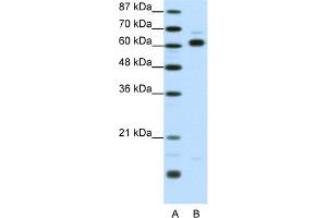 WB Suggested Anti-TRIP4 Antibody Titration:  1. (TRIP4 Antikörper  (Middle Region))